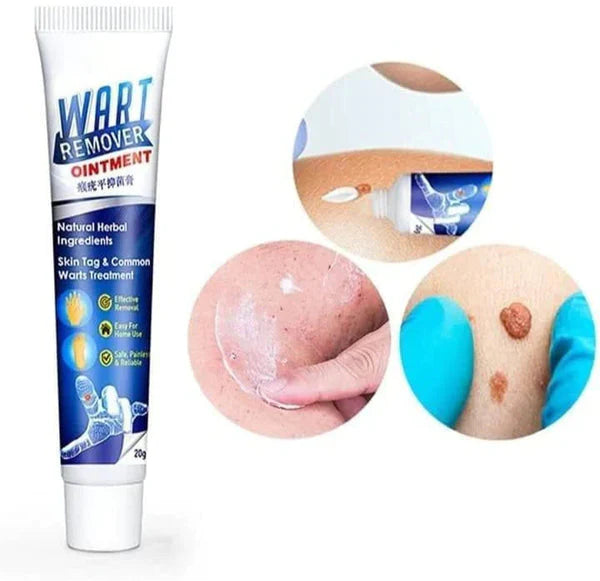 Herbal Wart & Skin Tag Removal Ointment