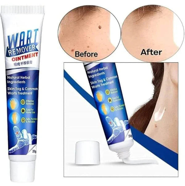 Herbal Wart & Skin Tag Removal Ointment